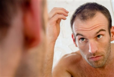 Rụng tóc, hói đầu - phải chữa theo cách khác