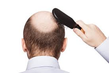 Rụng tóc: Nguyên nhân và các biện pháp điều trị